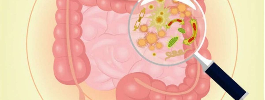 MICROBIOTA INTESTINALE